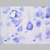 Neuronas Nissl 17.jpg
